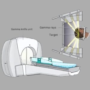 Gamma Knife Radiosurgery
