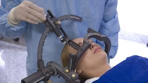 Functional Neurosurgery
